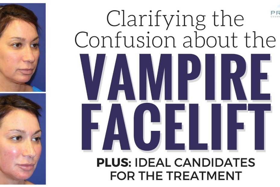What a Real Vampire Facelift® is, What it Does, and Who are the Right Candidates for It