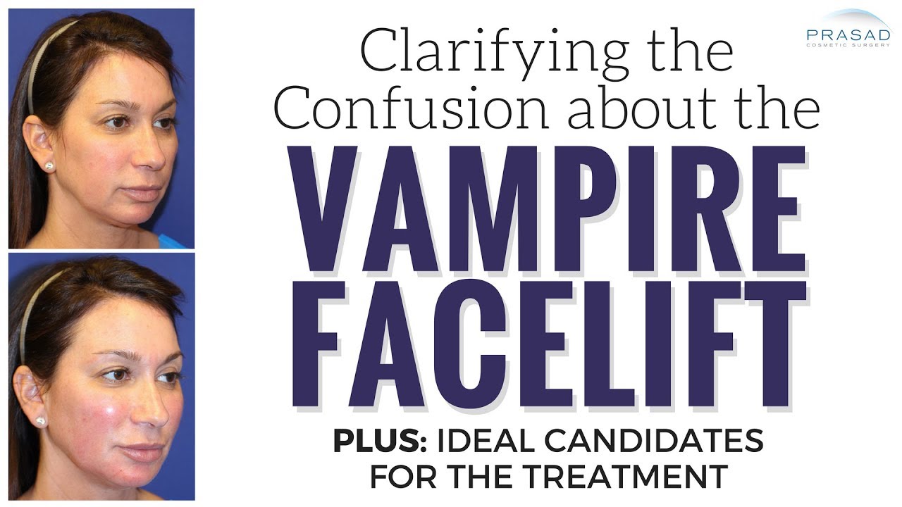 What a Real Vampire Facelift® is, What it Does, and Who are the Right Candidates for It