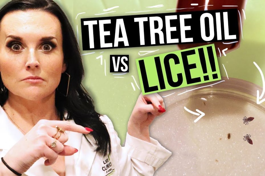 Removing LICE with TEA TREE OIL? - Watch this Before You Try!